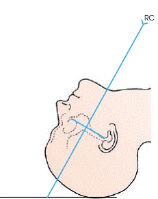 Proyección tangencial